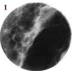 stevenratltner's tweet image. The potential of #Light is unique&amp;amp;open for new protocols. &quot;Science &amp;amp; Applications: Phase radiography for medicine&quot;  eli-laser.eu/science-applic… #BiophotonicsLab will join @ELI_laser for collaborative #research towards innovative solutions regarding #biophotonics applied to #cancer🔬.