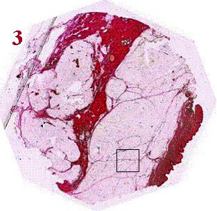 stevenratltner's tweet image. The potential of #Light is unique&amp;amp;open for new protocols. &quot;Science &amp;amp; Applications: Phase radiography for medicine&quot;  eli-laser.eu/science-applic… #BiophotonicsLab will join @ELI_laser for collaborative #research towards innovative solutions regarding #biophotonics applied to #cancer🔬.