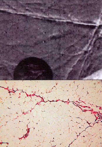 stevenratltner's tweet image. The potential of #Light is unique&amp;amp;open for new protocols. &quot;Science &amp;amp; Applications: Phase radiography for medicine&quot;  eli-laser.eu/science-applic… #BiophotonicsLab will join @ELI_laser for collaborative #research towards innovative solutions regarding #biophotonics applied to #cancer🔬.