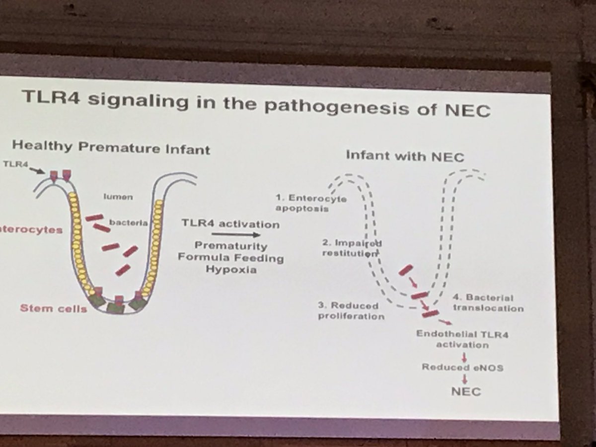 DrCBattersby's tweet photo. Another captivating talk from @davidhackam at #Neonatalupdate2018 Explaining the role of TLR-4 in NEC pathogenesis. Not so simple to just flick off the switch! https://t.co/nYMDNnacdp