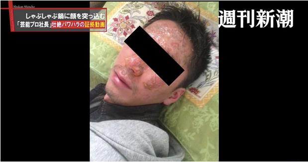 75 煮えたぎる鍋に部下の顔を 芸能プロ社長 凄絶パワハラ動画 デイリー新潮 Yahoo ニュース T Co Tnb2zxutx6 上げ直し