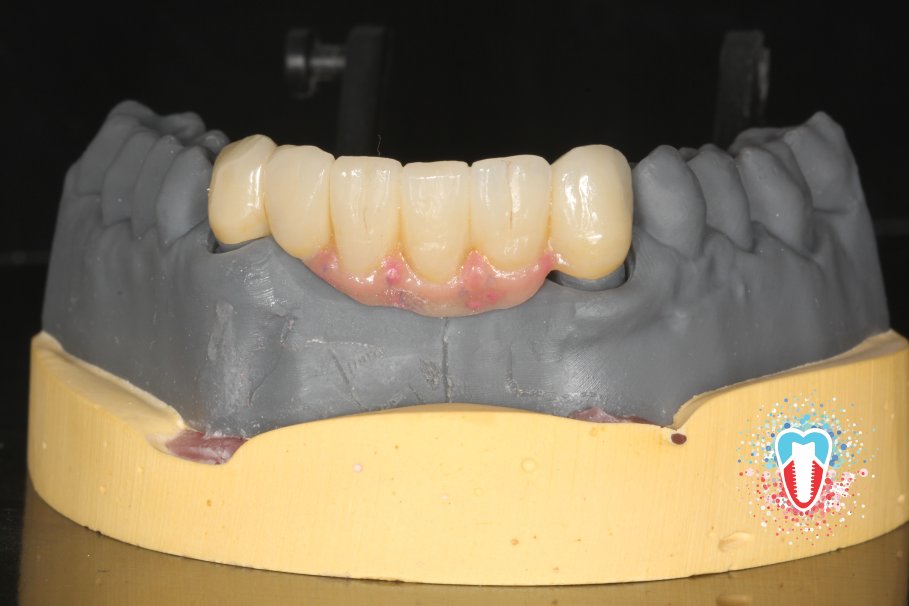 CBDentallab tweet media