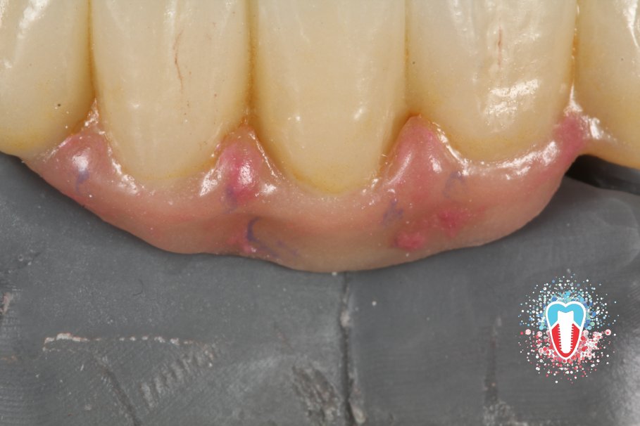 CBDentallab tweet media