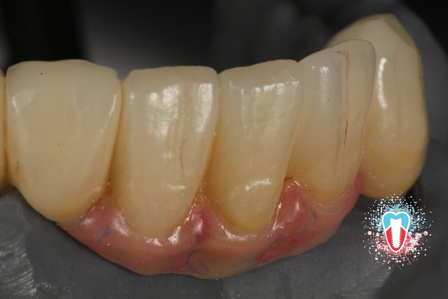 CBDentallab tweet media
