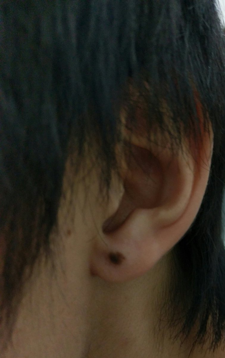 時雨芽依 どうでもいい個人情報を言う見た人もやる ピアスに間違えられる 耳たぶのほくろです 時雨芽依 どうでもいい個人情報を言う見た人もやる ピアスに間違えられる 耳たぶのほくろです