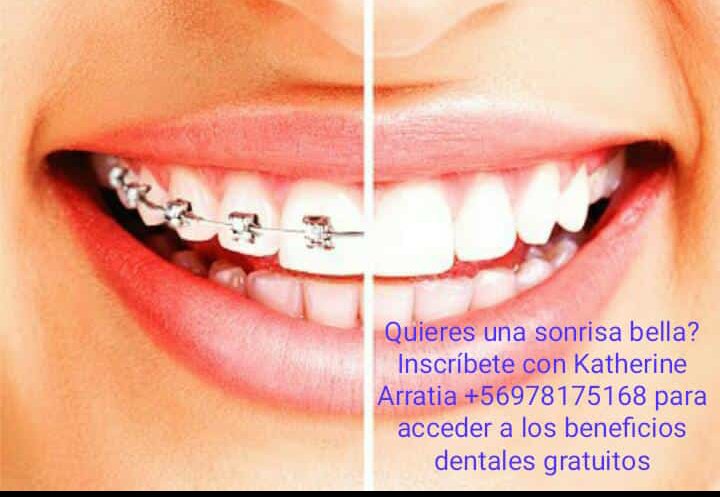 KatherineArrat2's tweet photo. @soyiquique Gratis!!! Ortodoncia (instalación de frenillos) y Diagnóstico Clínico Dental Gratis!!
+56878175168 inscripción https://t.co/GkBmcAFWbA