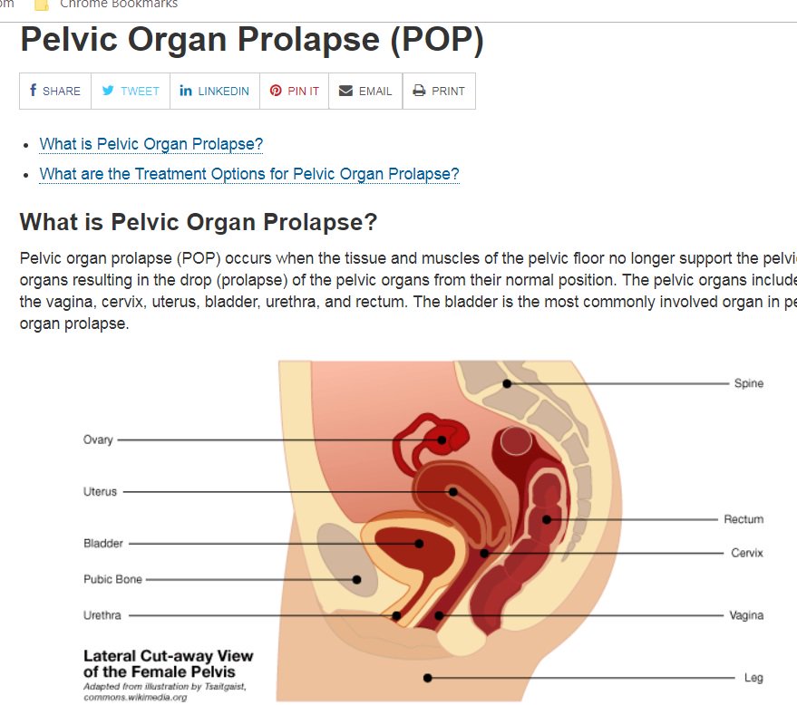 FDA Will revisit mesh used for pelvic organ prolapse in February. Expect a public turnout! ow.ly/8FB330mIADe
