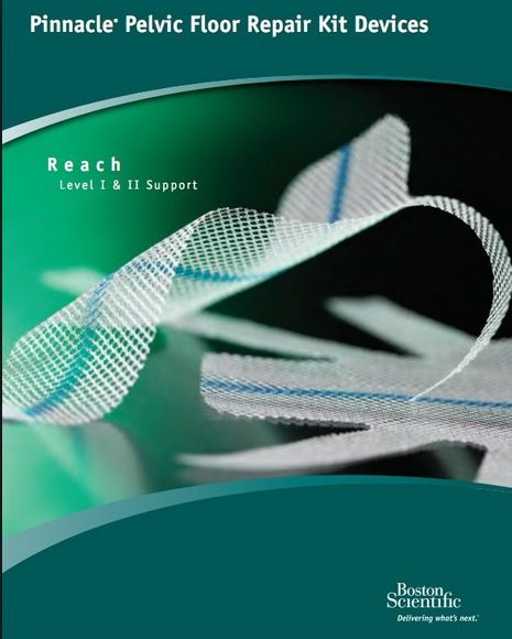 JaneAkre's tweet photo. Pelvic Organ mesh on the hot seat by the FDA in Feb. 
https://t.co/ZqtpU9oYY4 https://t.co/ztGC8Y90oG