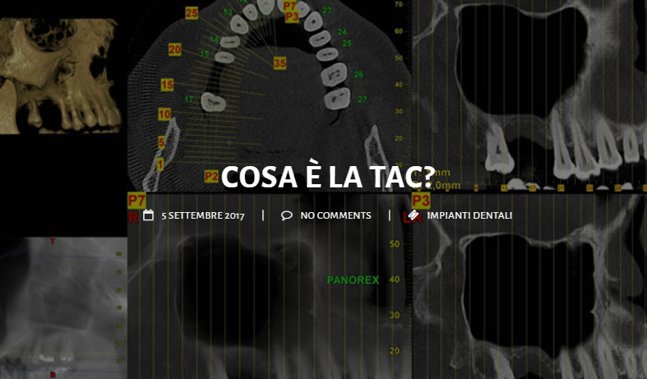 Prima di inserire gli impianti dentali, il paziente deve essere sottoposto ad una serie di accertamenti diagnostici, ecco perché la TAC può rivelarsi utile ow.ly/ePBK30mmaJH #saluteorale #prevenzione