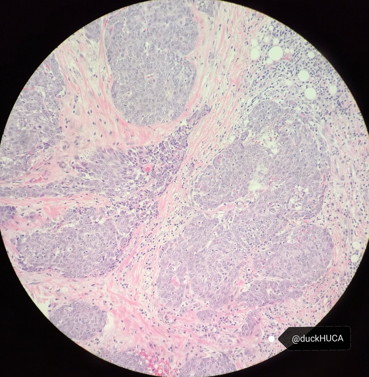 Héctor-Enrique Torres-Rivas, MD, MIAC tweet media