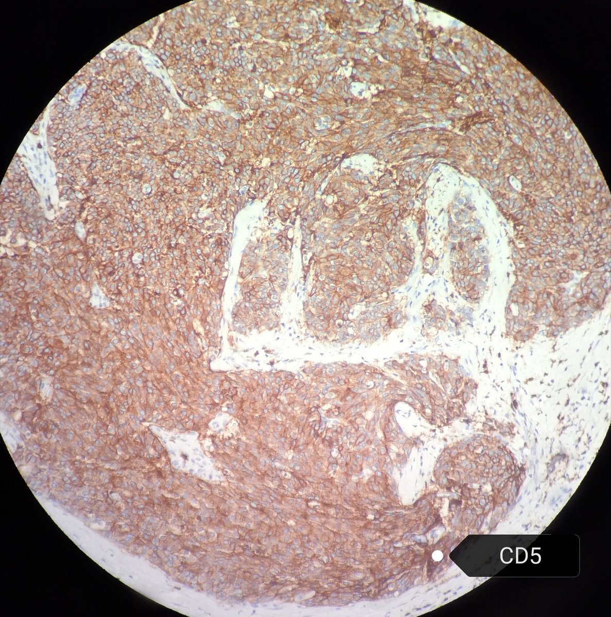 Héctor-Enrique Torres-Rivas, MD, MIAC tweet media