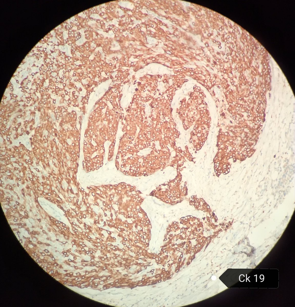 Héctor-Enrique Torres-Rivas, MD, MIAC tweet media