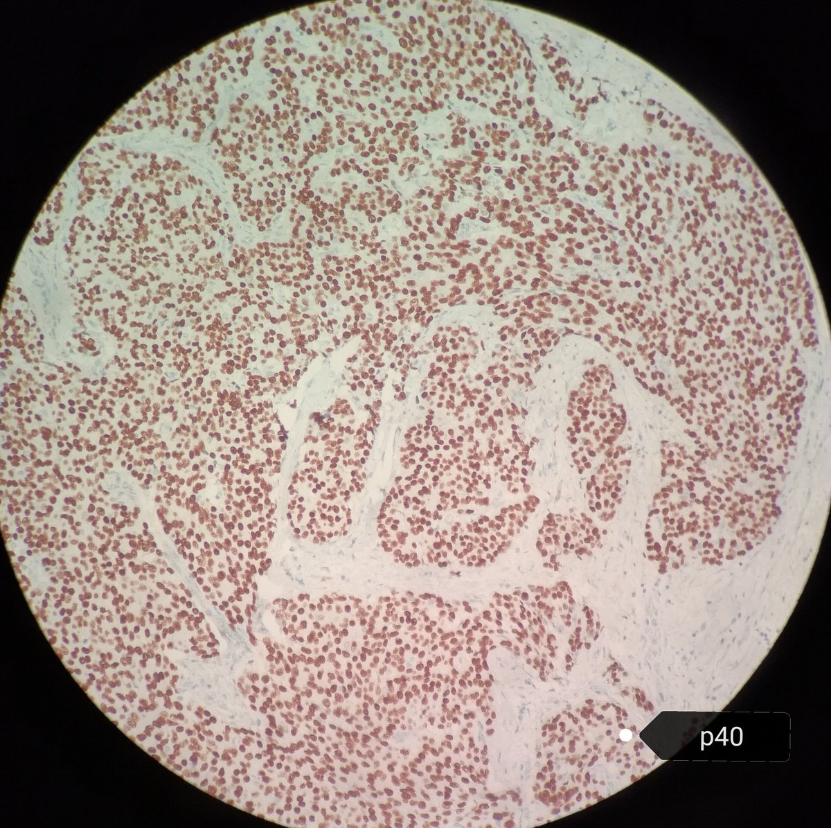 Héctor-Enrique Torres-Rivas, MD, MIAC tweet media