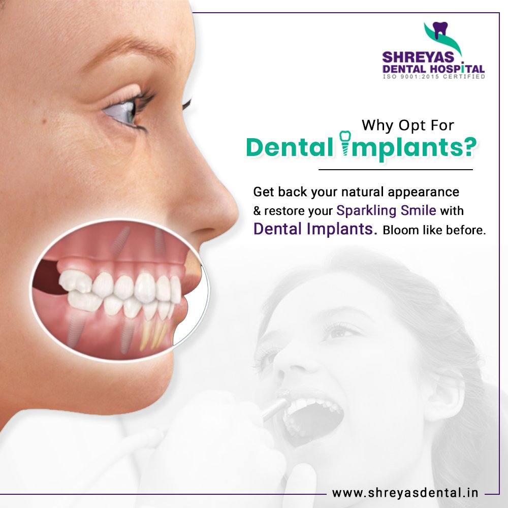 shreyas_dental's tweet image. Why Opt For Dental Implants? 
Get back your natural appearance and restore your sparkling smile with Dental Implants. Bloom like before.

Book your appointment: +91-9712994608
Visit: shreyasdental.in/dental-implant…

#DentalImplant #DentalImplantsSpecialist #BasalImplants #Ahmedabad