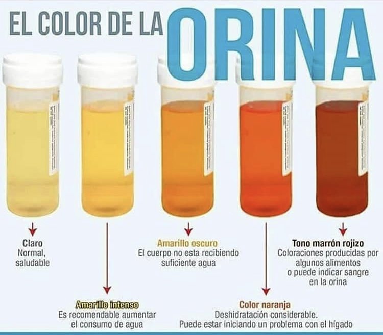 que significa el color de la orina en niГ±os