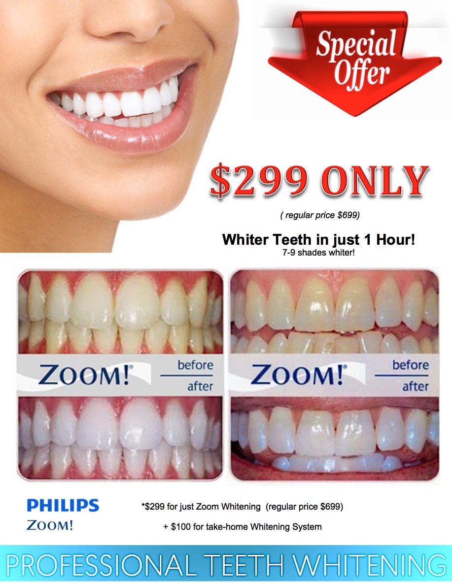 TenBrook Orthodontics on Twitter "Do you want whiter teeth? See your