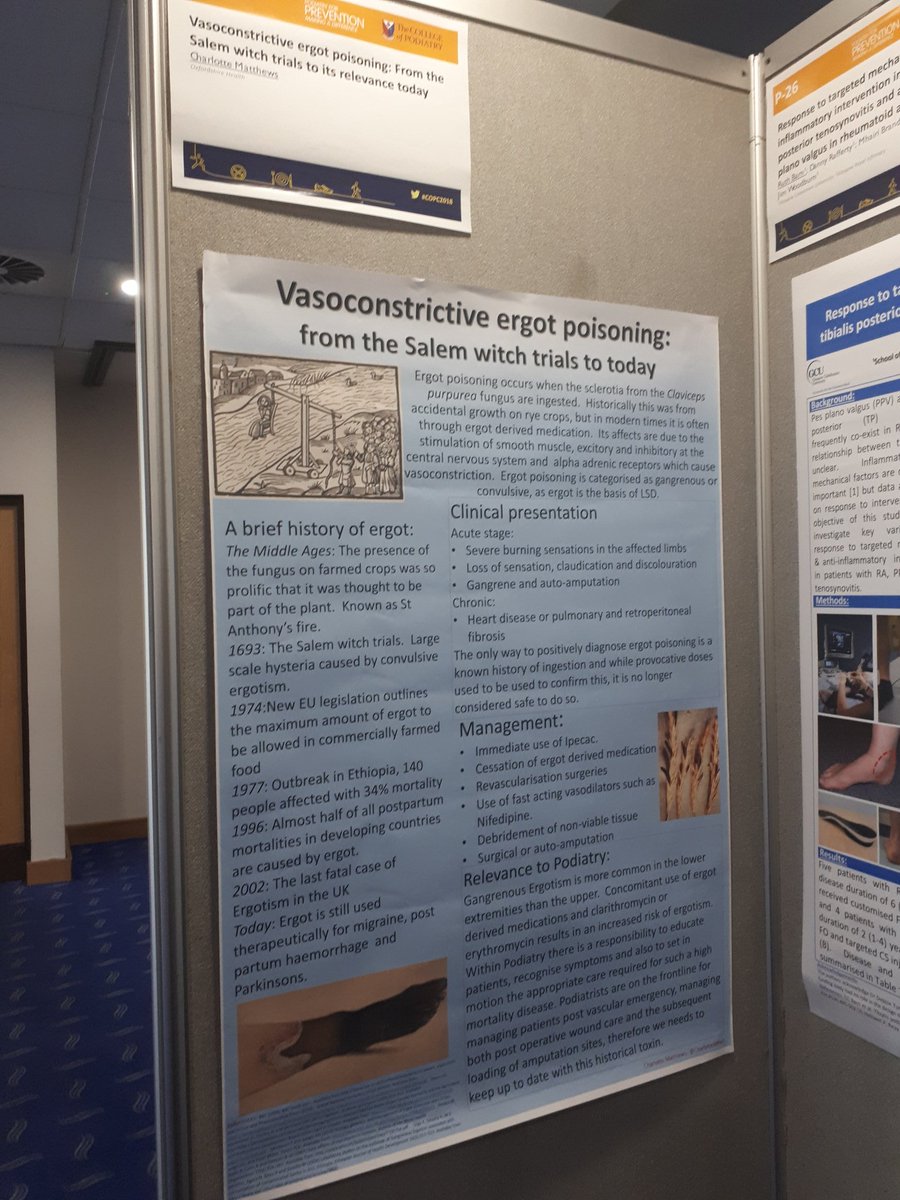 CharlotteMpod's tweet photo. come check out my poster in Bournemouth at the College of Podiatry conference ! Give it a vote if it floats your boat! #COPConference2018 https://t.co/nn77PTxu23