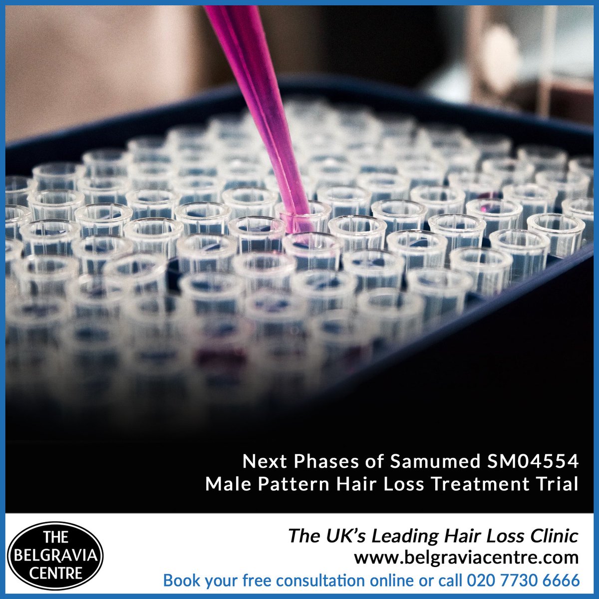 Belgraviacentre's tweet photo. Find Out About the Next Phases of Samumed SM04554 Male Hair Loss Treatment Trial: https://t.co/h3WD7R4bxv #hairloss #hairgrowth #belgraviacentre #hairlossblog #samumed #sm04554 #malepatternbaldness #mpb #hairlosstreatment #hairlosssolution #hairgrowthproduct #menshair https://t.co/MwPNyiea0I