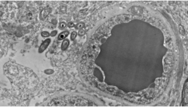 OpkoHealthEurop's tweet photo. ¿Hay bacterias en el cerebro?

https://t.co/hRwkhuESBj https://t.co/B2UdWRANtG