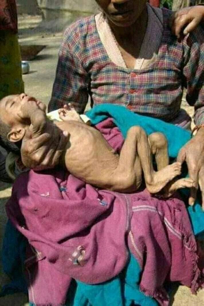 sabitakattel7's tweet image. १८करोडको गाडिको बारेमा भन्दा पहिला यि गरिब,निमुखा र ढुहुराको बारेमा सोचिदिए   राष्ट्रिपति ज्यु संन्सार कै शक्तिसालि राष्ट्रिपति महिला हुनुहुने थियो ।। 
         #तर....... ...😫😫😫😫