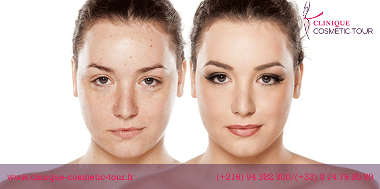 CliniqueTour's tweet photo. Votre #Visage raconte votre histoire , assurez-vous que c'est la bonne. Si des problèmes de peau ou de vieillissement ternissent votre teint, nous pouvons vous aider à récupérer ce qui vous appartient: santé, éclat et confiance.
Contactez-nous : 
🌐 https://t.co/5jNzvcQ4U0 https://t.co/1k5ooDDkwB
