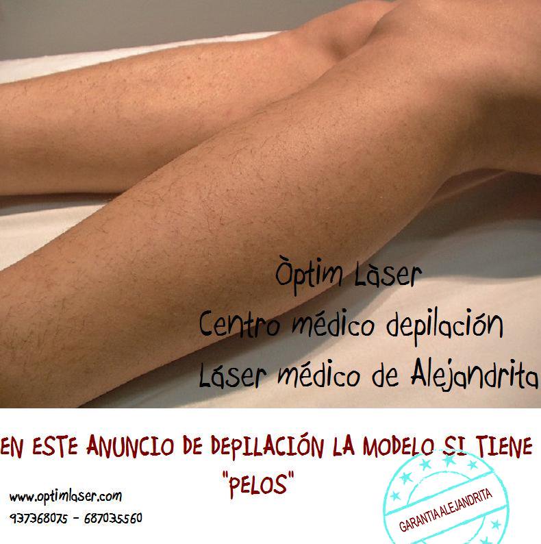 Òptim Làser (@LaserOptim) / Posts / X