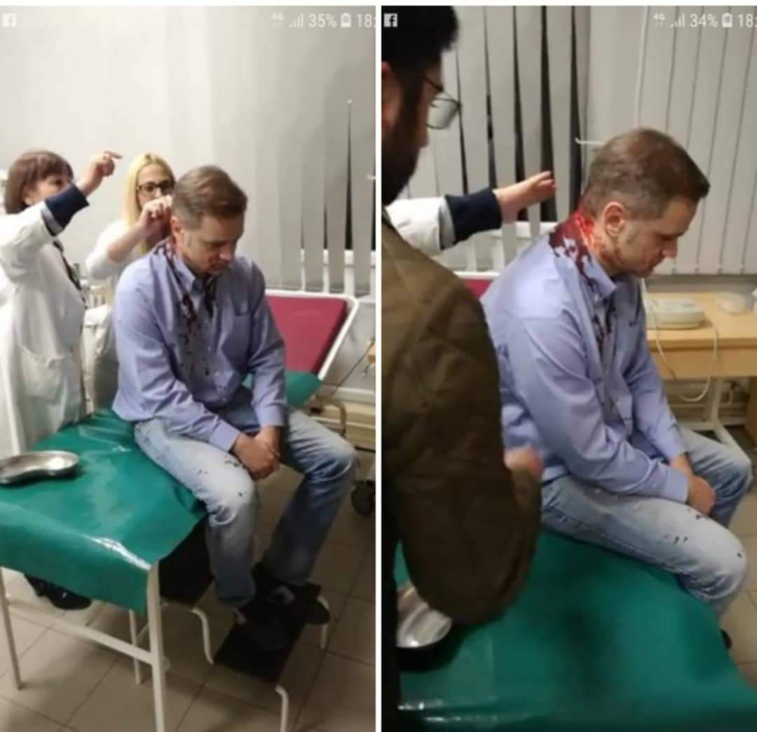 Nasilje u bilo kakvom obliku osudjujem,ali da promovišem "saveze" sa dotičnim nemam nameru.#misliteotome