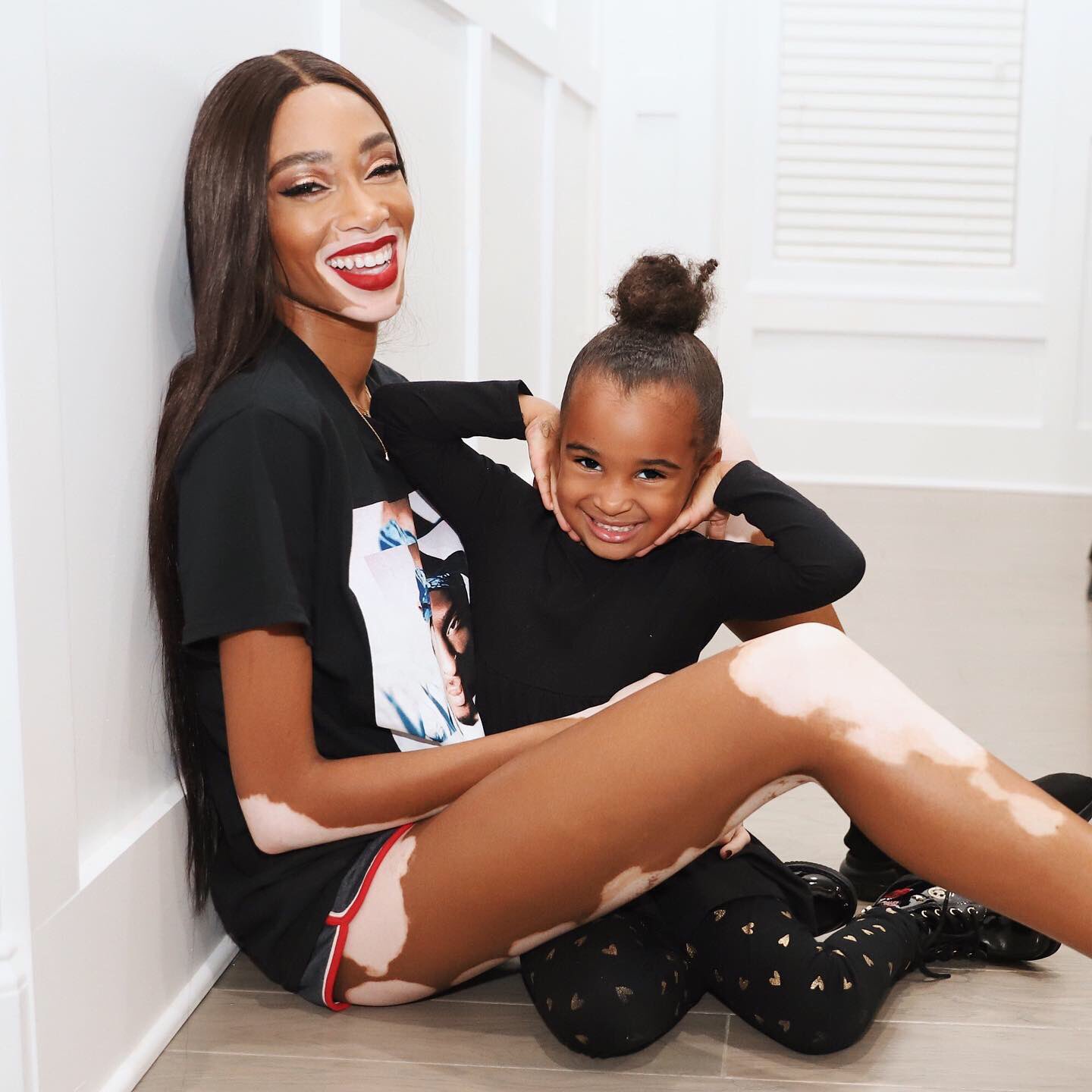 Winnie Harlow