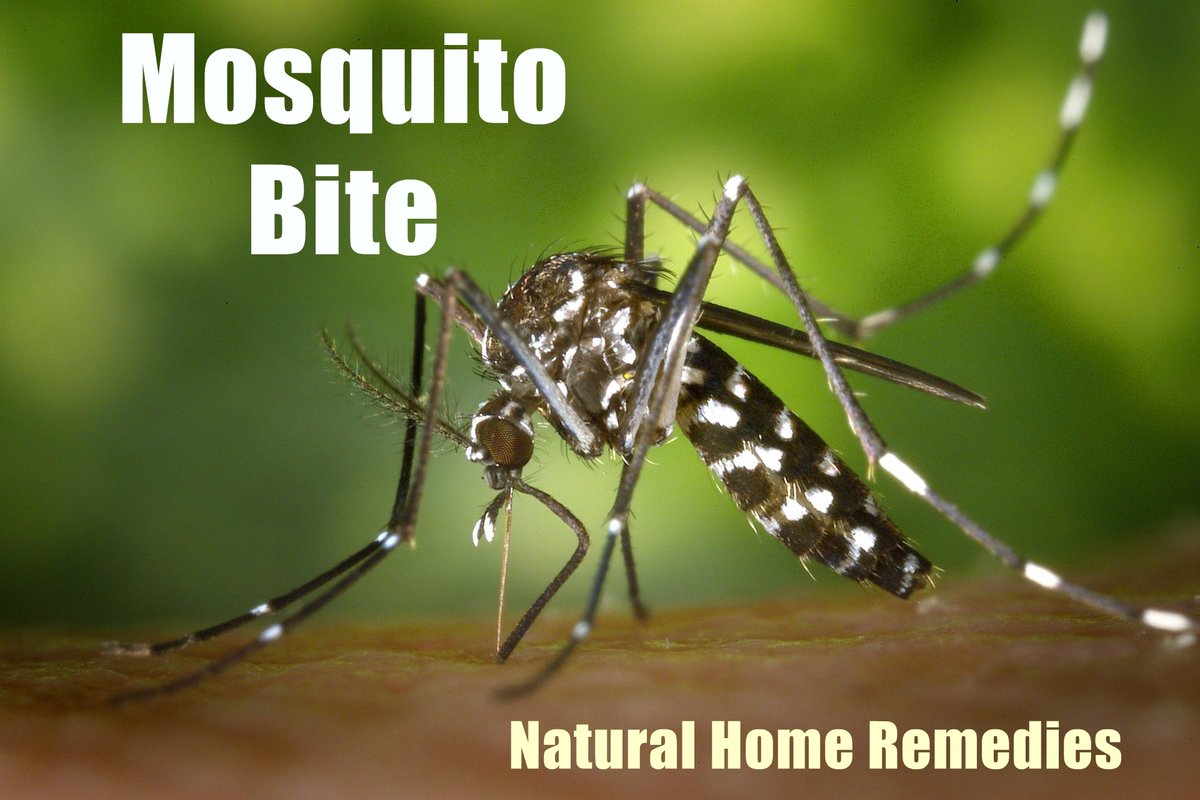 bulkuse's tweet photo. Treat Mosquito Bites With These Best Home Remedies #HomeRemedies #mosquitobites https://t.co/Oid75r6Eoy https://t.co/x0fzGRvX1N