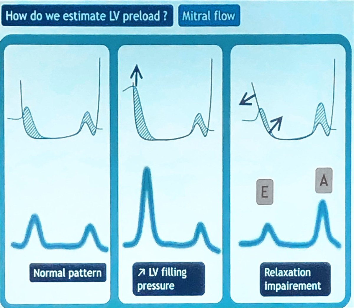 Wilkinsonjonny's tweet photo. Xavier Monnet and key points regarding LV preload determination. #IFAD2018 #foamed #foamc c#pocus @Fluid_Academy https://t.co/SENRsq7ge5