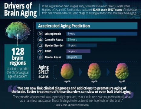 Largest brain study of 62,454 scans identifies drivers of brain aging bit.ly/2OZW6Vt #mentalhealth #aging #brain