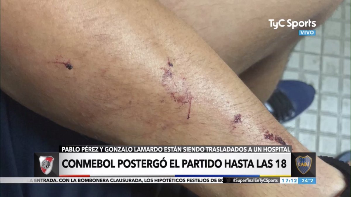 la12tuittera's tweet photo. Los cortes que recibió Pablo Pérez https://t.co/3E2HwwC896