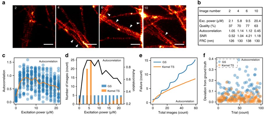 JakobsLab's tweet photo. New paper about #MachineLearning assisted optimization of #superresolution microscopy by our former colleague from #HellLab Flavie Lavoie-Cardinal. She's not on Twitter though, but I'm sure she's happy to answer your questions by good old email 😁 https://t.co/2PZq16dyh6 https://t.co/e0Mmr4nAhW