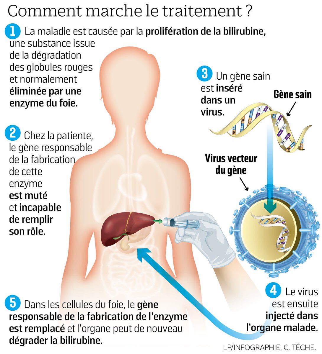 #TELETHON2018 Thérapie génique : Un nouveau traitement pour guérir une maladie rare et jusqu’ici incurable >> leparisien.fr/societe/sante/…