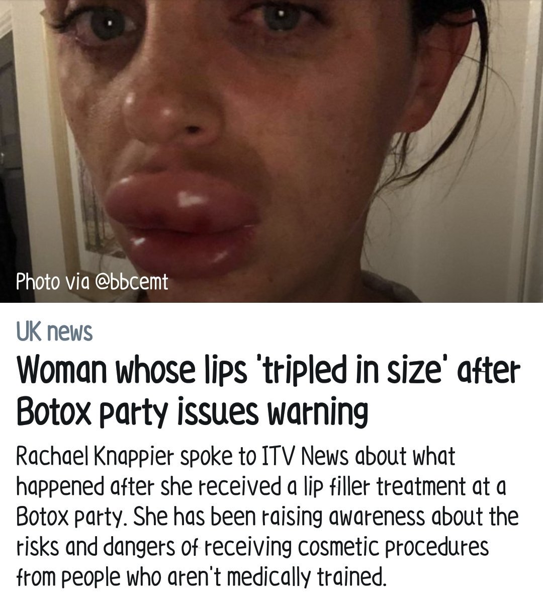 Shayna_Skin's tweet photo. Maybe, if celebrities we're actually HONEST about their work they had done and what doctors they go to, stuff like this wouldn't happen 🙄 sick of seeing all this work on such young beauties! #icant #iblamehollyweirdos https://t.co/AA5xuQMUUG