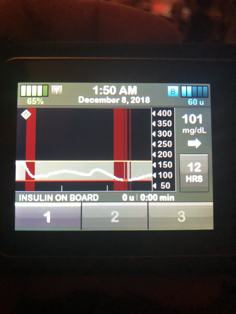 gwsuperfan's tweet image. Basal IQ doing its job. Love the confidence to not worry about lows. Thanks, @TandemDiabetes! 

#tsliminthewild #tslimx2 #BasalIQ