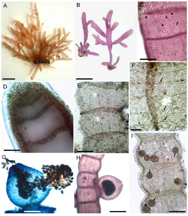 New records of benthic marine algae from Morocco
Mustapha Hassoun, Hanaa Moussa,Ghizlane Salhi,HanaaZbakh, HassaneRiadi &amp; Mohamed Kazzaz revistas.uma.es/index.php/abm/…