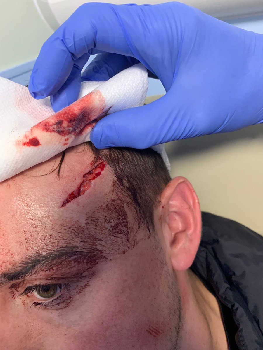 StMargaretsbury's tweet photo. Update on Tommy Fletcher -
All patched up and on his way home, Great work from our Physio today Nahid also reacted quickly and stemmed the bleeding 🔴⚫️
#isitbleeding? https://t.co/vg22gPWtOG
