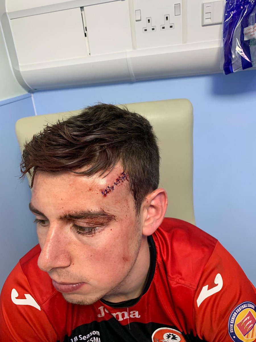 StMargaretsbury's tweet photo. Update on Tommy Fletcher -
All patched up and on his way home, Great work from our Physio today Nahid also reacted quickly and stemmed the bleeding 🔴⚫️
#isitbleeding? https://t.co/vg22gPWtOG