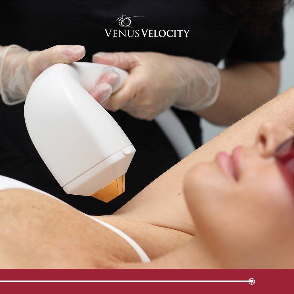 VenusConceptFr's tweet photo. ➡ @VenusVelocity le laser à diode pour épilation plus moderne, facile et rapide à utiliser est arrivé en France ! #laser #epilation #laser #diode #poils #centrelaser #medecin #esthetique #diodelaser
Essayez vite le Venus Velocity : https://t.co/TtYLNfJUU3 https://t.co/5rRy1RCbdm