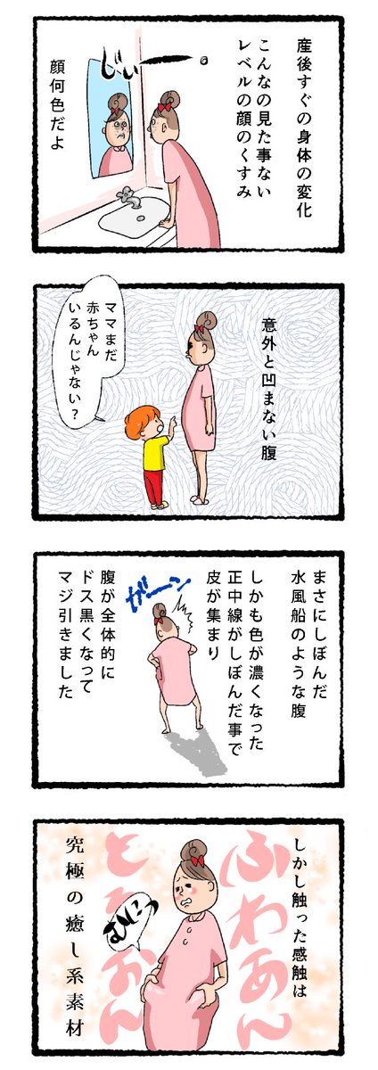 藤丸ぐっ子 出産直後の身体の変化 他の漫画はこちらからhttps T Co 50dydqpv13 産後 出産直後 入院中 妊娠線 色素沈着 正中線 産後のくすみ 産後のお腹 漫画 出産レポ漫画 出産レポ 漫画 マンガ 産後トラブル T Co Hxr5einvba