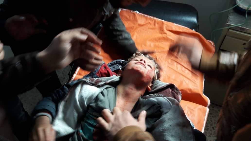 SyriaCivilDef's tweet photo. A child was injured in #Alteh town, & many civilian property were destroyed, after artillery bombardment with more than 30 shells targeting the towns of #Altmanah and #Umm_Jalal eastern #Idlib.
13:05 #Syria local time. https://t.co/IQXDPuW3dE