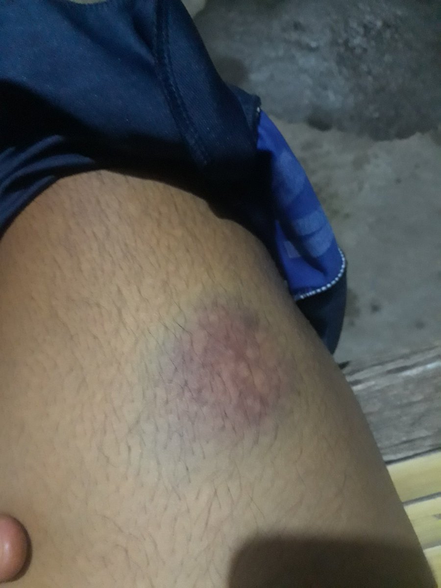 Sakitnya nyutnyutan😔😔😔