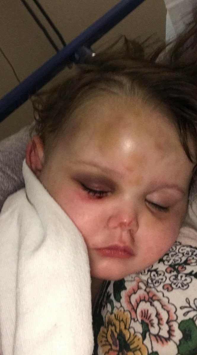 Please help baby Cae.  link.email.dynect.net/link.php?DynEn…