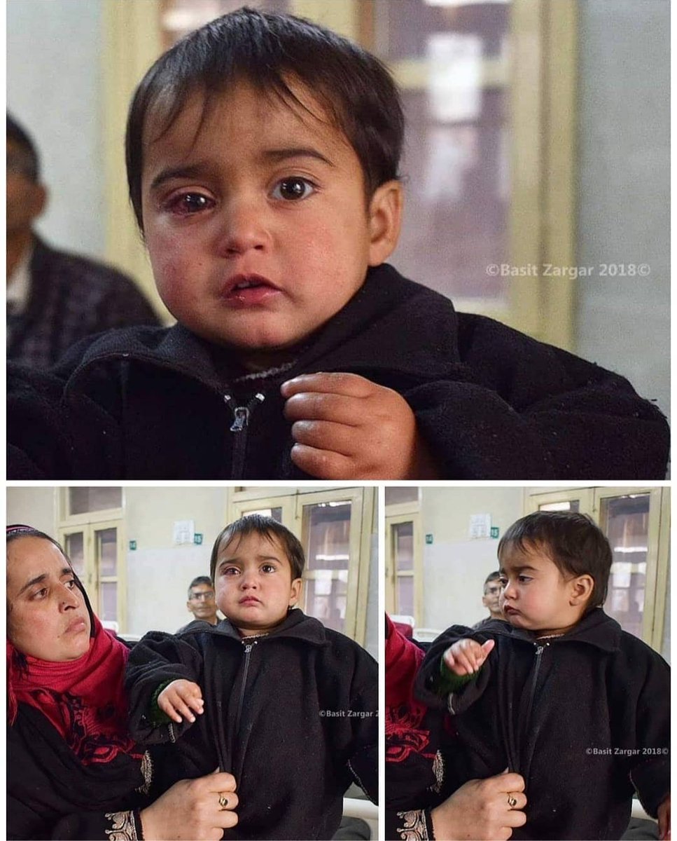 Doctors unsure if Kashmir’s youngest pellet victim will regain complete sight .Eighteen-month-old Hiba Nisar, the youngest pellet victim in Kashmir💔 #FreeKashmir