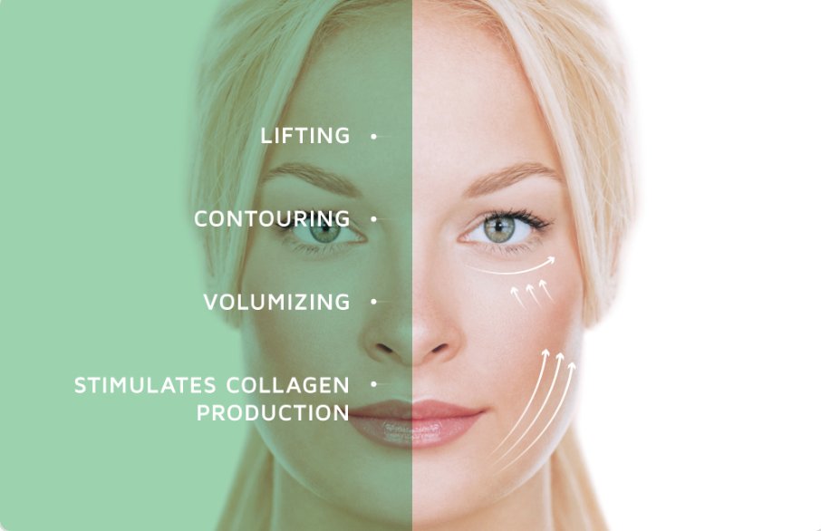 monarchlaser's tweet image. Forget what you know about threads! Novathreads™ are absorbable and easy to insert. This means no more complications✔️
#PDOthreads #absorbable #saggingskin #looseskin #lunchtimetreatment #skintightening #noninvasive #novaknowhow #noninvasivefacelift
novathreads.com