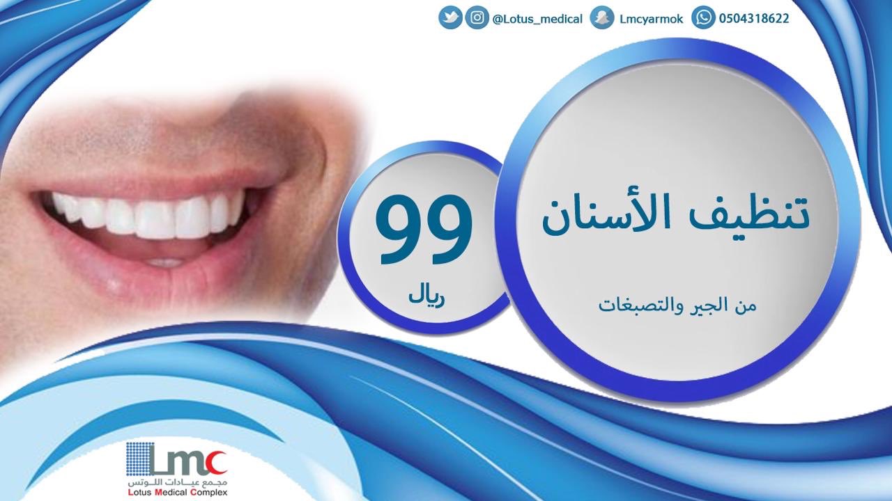 اسعار تنظيف الاسنان
