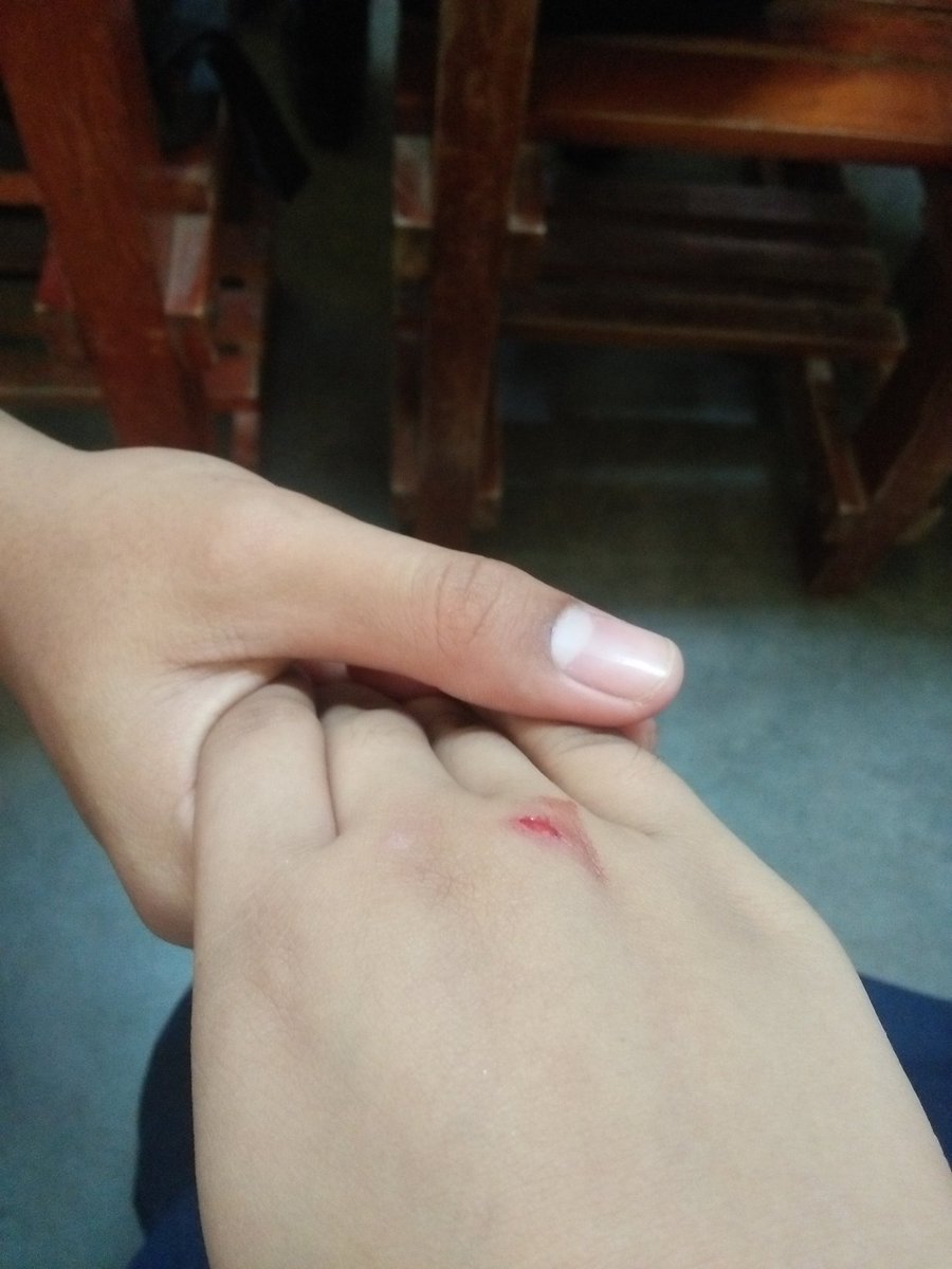 junnerissa's tweet image. Di naman masakit. Sweet sweet ba rei hahahahaha arot