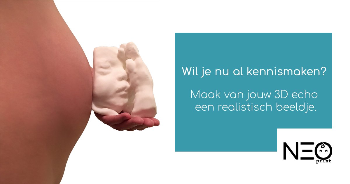 NeoPrint_3D's tweet photo. Van een echo van jouw #baby naar een echt beeldje van dat lieve kleintje in jouw buik?

Neo-Print: een uniek aandenken aan die bijzondere periode van je #zwangerschap! #3Dprinting @3dprint_baby
https://t.co/cBJGwJNWnt https://t.co/SUWujR0rWl