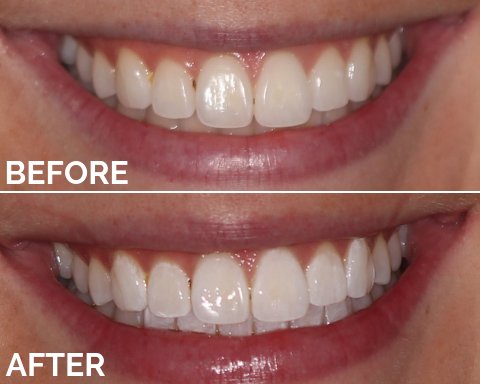 halosmile_'s tweet photo. We hope you are having a terrific #TeethTuesday! Don't forget to order your HaloSmile kit just in time for the holidays. HaloSmile's got you covered during all holiday dinners and family reunions. Show off that smile 🤩
#WhiteTeeth #Cosmetics #TeethCosmetics #BrightSmiles https://t.co/0UvtIKsLPs